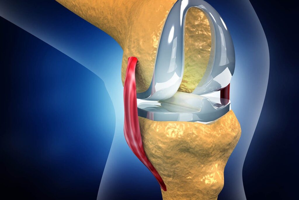 Best Hospital For Knee Replacement Surgery in Noida